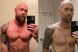 Las huellas del coronavirus: el terrible cambio físico de un hombre que tuvo covid-19 | Internacionales