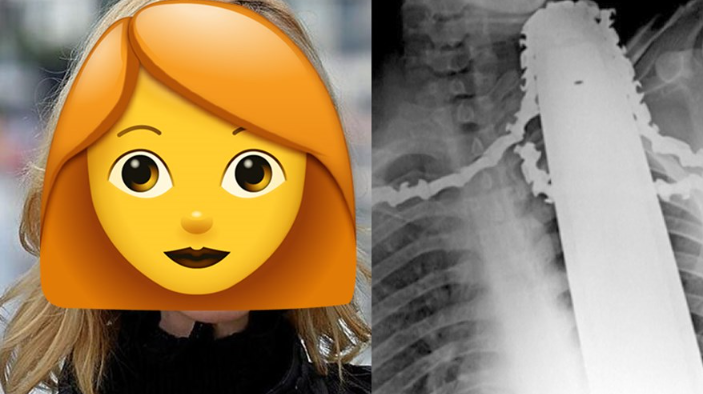 ¡Famosa actriz tuvo un duro accidente con la motosierra y casi no la cuenta! | Espectáculos