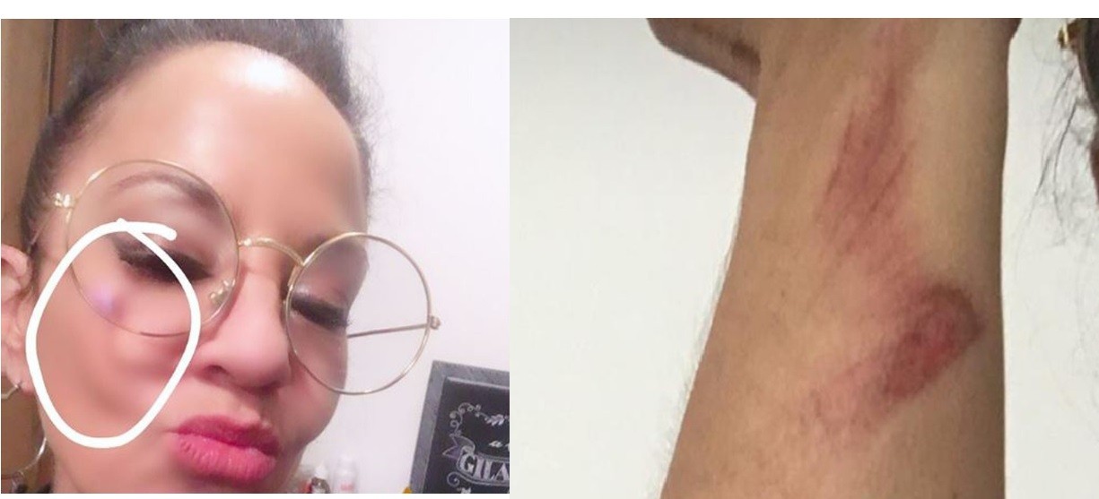 Miss Bolivia apuntó en redes sociales a su ex por violencia de género | Espectáculos