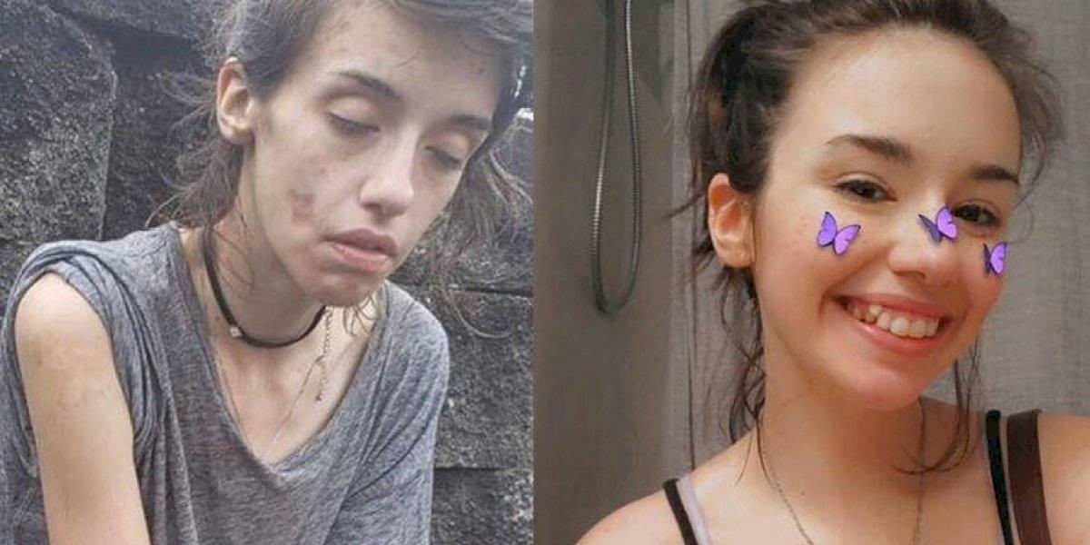 Una chica subió su foto "antes y después" para mostrar cómo se recuperó de su adicción a las drogas | Internacionales