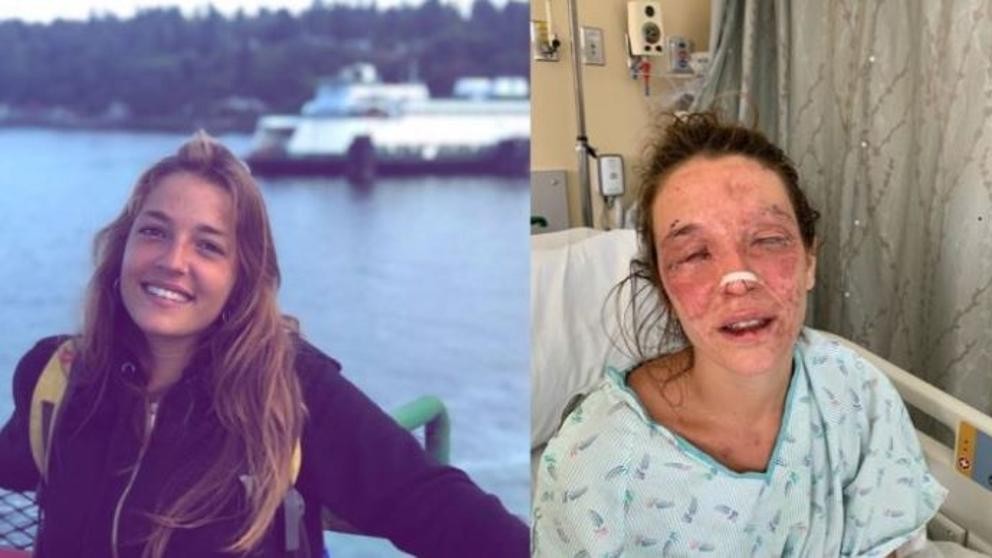 Intentó hacer jabón con un tutorial de Internet y se quemó los ojos | Internacionales