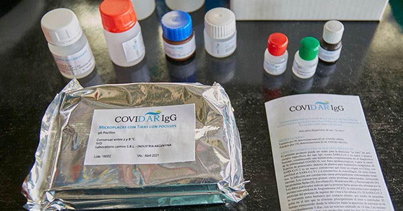 La producción del test serológico argentino para coronavirus llegó a los 100.000 ensayos | Salud