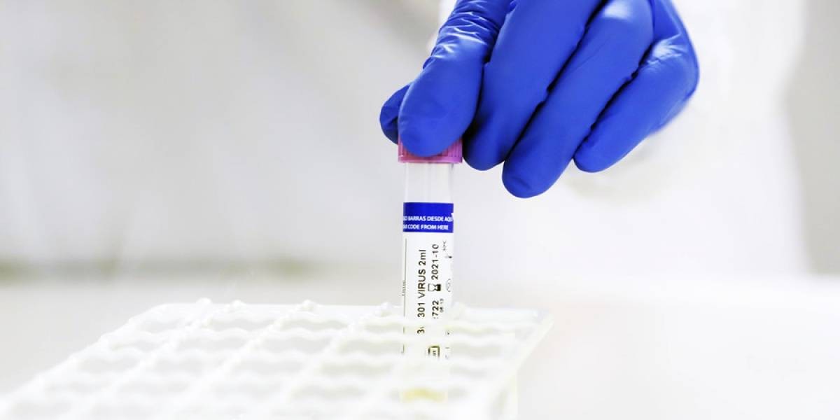 Hallan una nueva cepa del coronavirus: es hasta 9 veces más infecciosa que la original | Internacionales