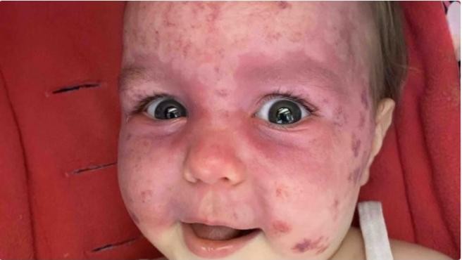 El calvario de Ariya: la beba tiene una enfermedad rara y se dificulta su atención por el coronavirus | Internacionales