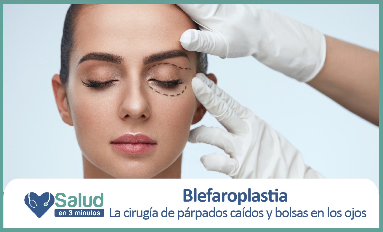 Párpados caídos, un problema que tiene solución | Salud