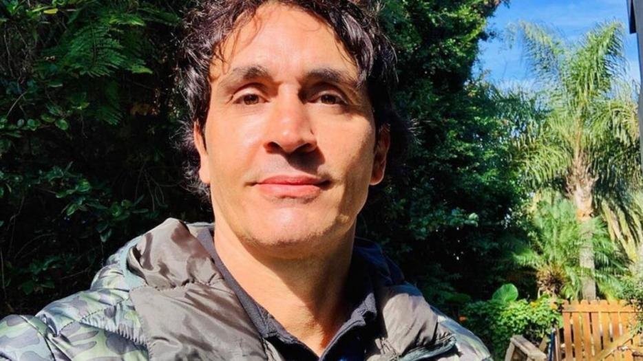 Sebastián Estevanez mostró como le quedó la cara luego de un accidente doméstico | Espectáculos