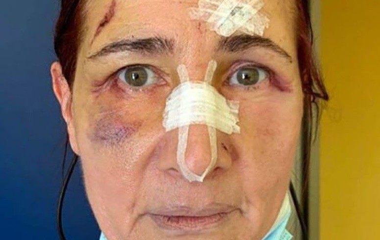 Un hombre el dio una brutal paliza a una mujer porque le pidió que use el tapaboca | Internacionales