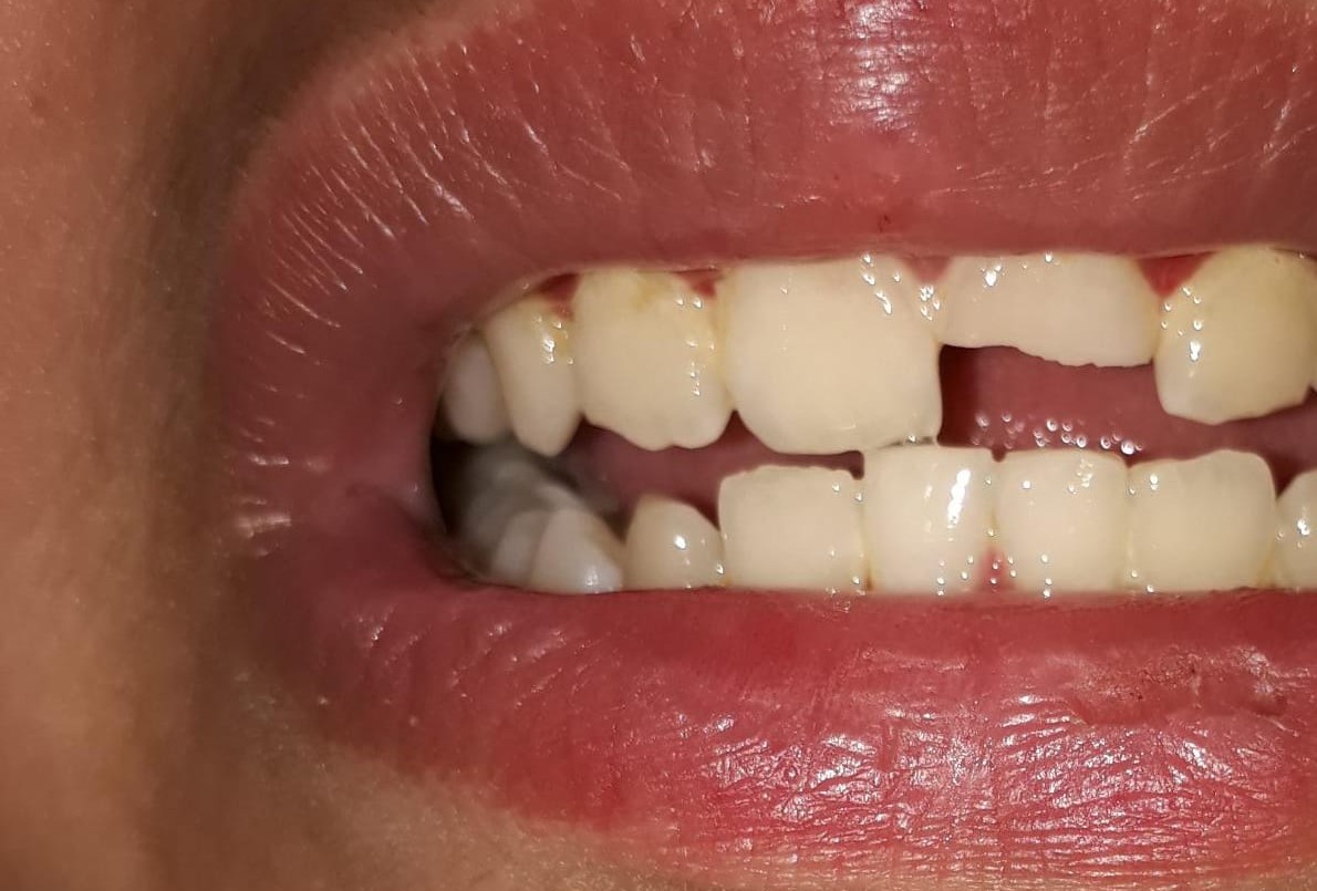 Un hombre golpeó a su hijo de 12 años y amenazó con tirarlo a las vías del tren | Actualidad