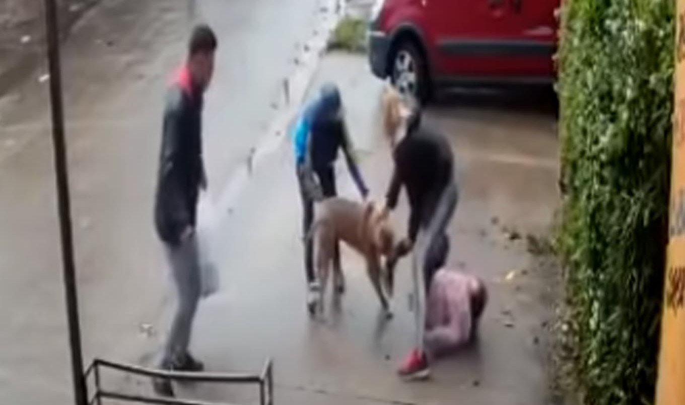 Habló la familia de la nena atacada por un pitbull: "Tiene la pierna destrozada" | Actualidad