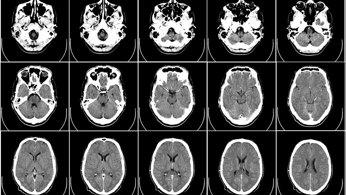 Era fanático de las plantas, estaba arreglando su jardín y una infección de la tierra le disolvió el cerebro | Internacionales