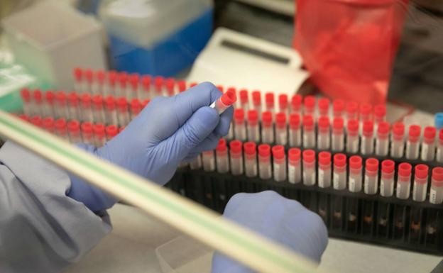 Coronavirus: estudios indican qué tipo de sangre es más susceptible de desarrollar cuadros graves | Internacionales