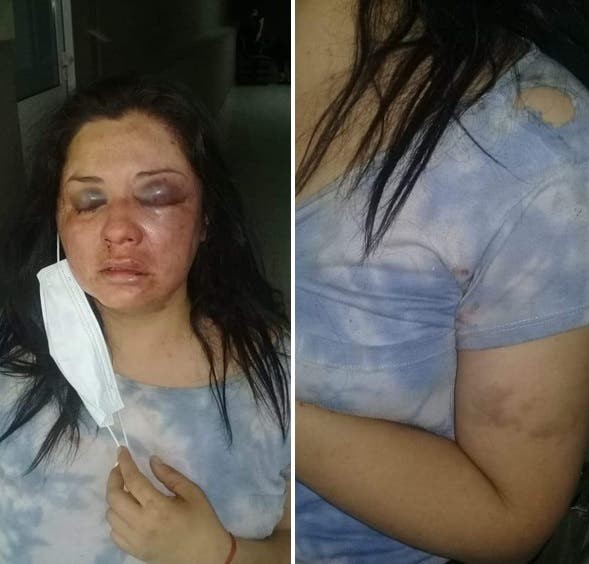 Tucumán: una mujer se escapó del hospital por miedo a que su marido la mate | Actualidad