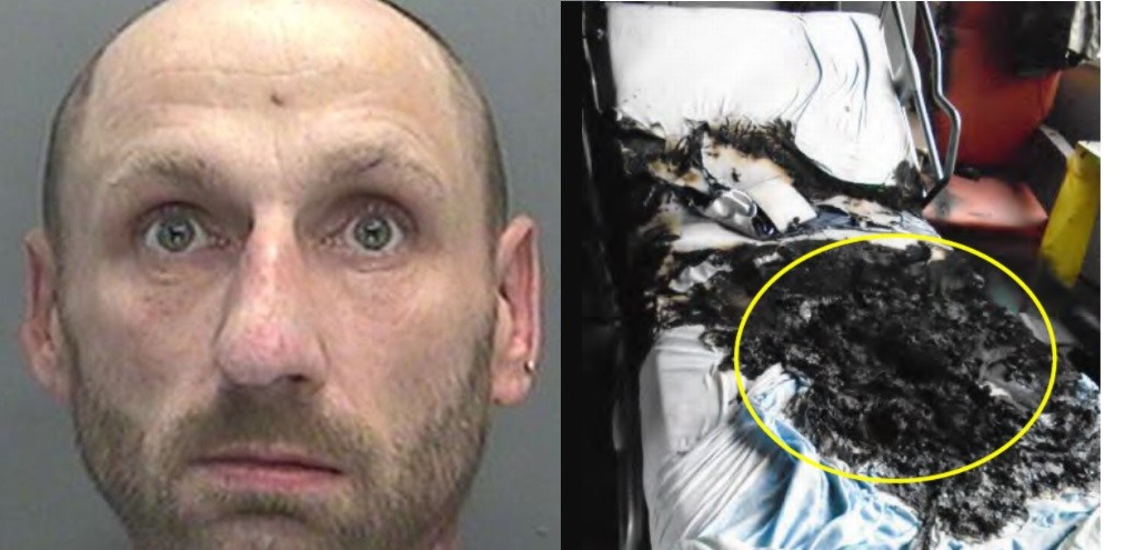 Incendio en un hospital por un paciente que intentó fumar cuando usaba máscara de oxigeno | Internacionales