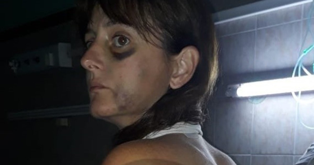 Le dio una terrible paliza a su pareja y la Justicia lo dejó en libertad | Actualidad