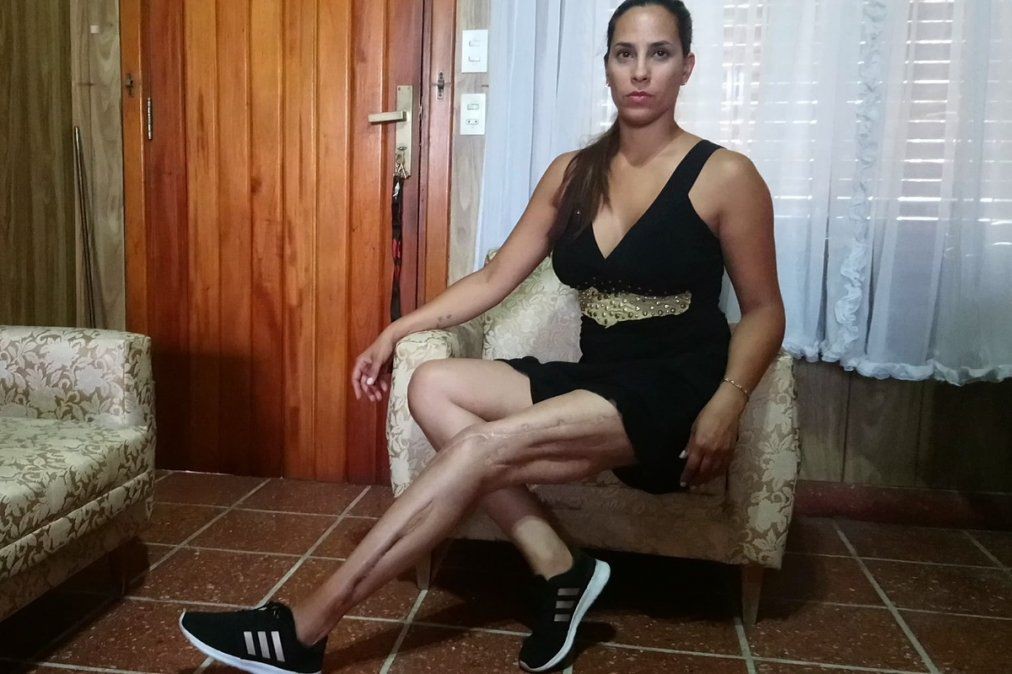 Detuvieron un ex piloto de TC que fue condenado por dispararle con una escopeta a su ex esposa | Actualidad