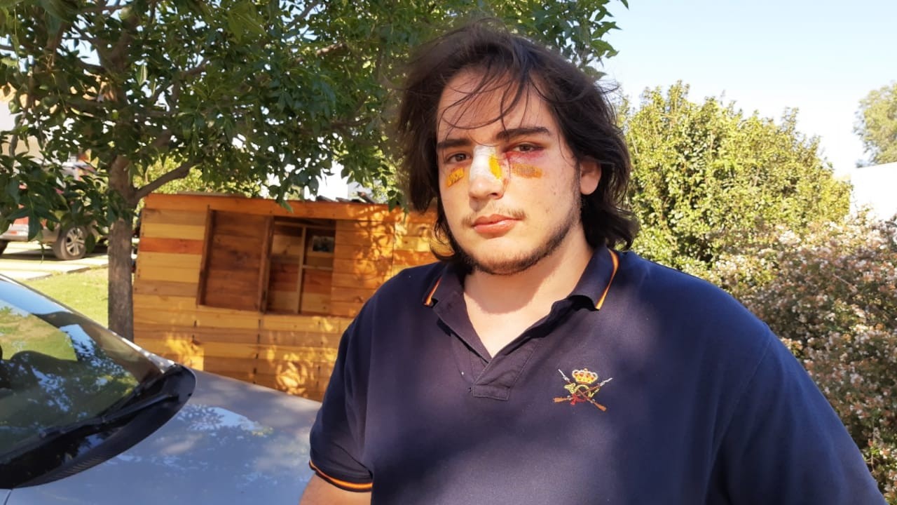 Dos imputados por la golpiza a Lautaro Insúa | Córdoba