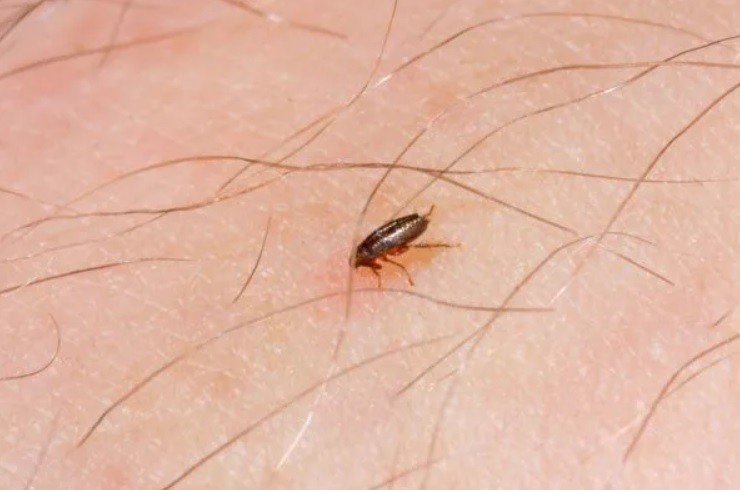 Conicet: investigan si las pulgas ocasionan cuadros febriles en humanos | Actualidad