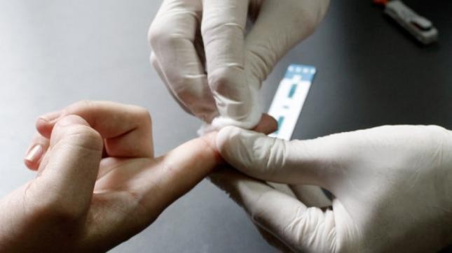 Pruebas gratuitas: realizarán la Noche de los Testeos de VIH en más de 30 ciudades | Actualidad