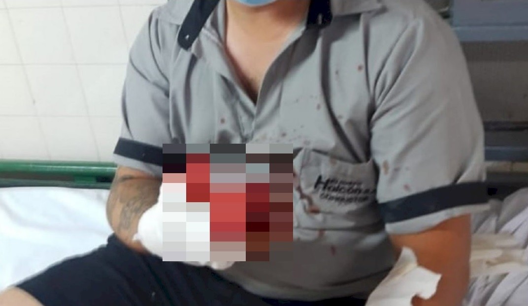 Acusó a un colectivero por una infidelidad y le amputó el dedo | Actualidad