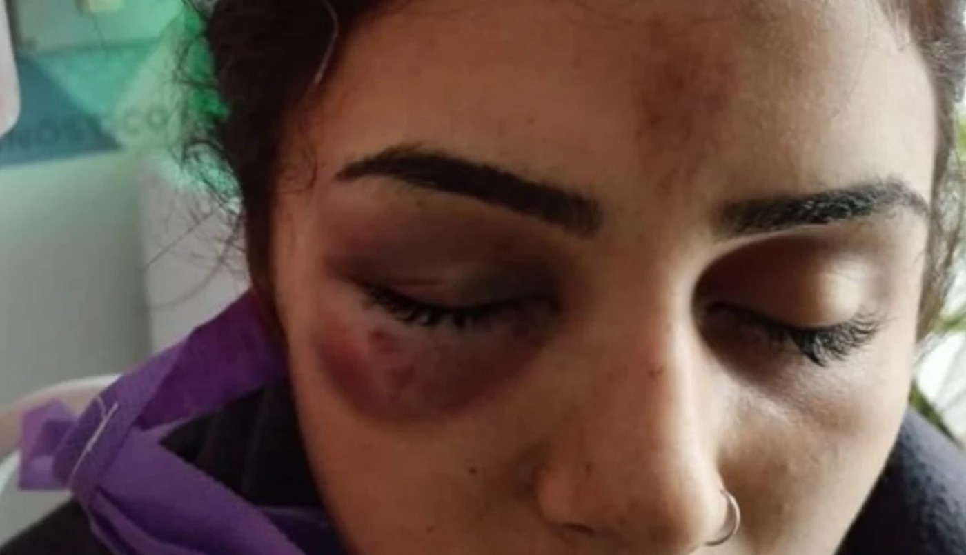 La sorprendieron de atrás tres chicas y la molieron a golpes: tiene fractura de cráneo | Córdoba