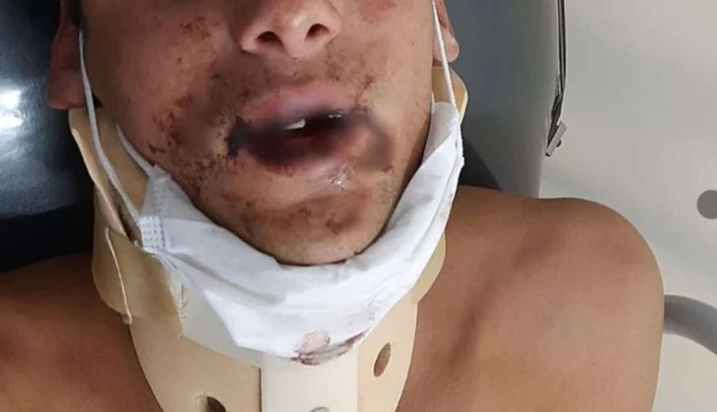 Identificaron a 4 rugbiers por la brutal pelea en el boliche de Mar del Plata | Actualidad