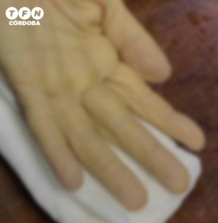 Exitoso trasplante de mano en el Hospital de Urgencias | Córdoba