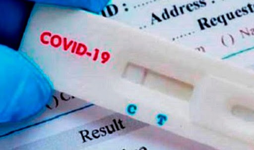 Autorizaron a vender en farmacias un test rápido de coronavirus: precio y cómo funciona | Actualidad