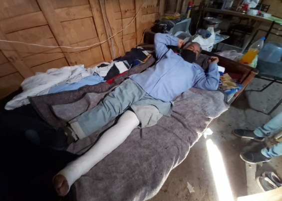 Ladrones enojados por magro botín, le quebraron varios huesos a la víctima | Córdoba