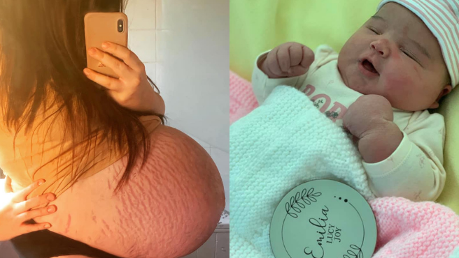 Los médicos pensaron que iba a dar a luz a gemelos, pero tuvo un bebé de 6 kilos | Internacionales