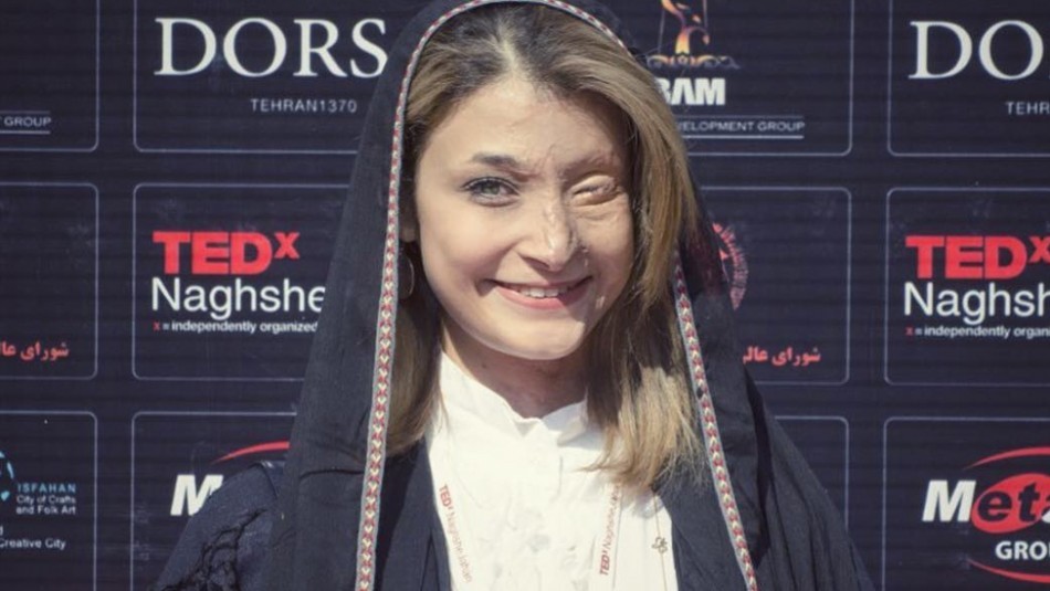 La chica que fue atacada con ácido cuenta su calvario y muestra su cara | Internacionales