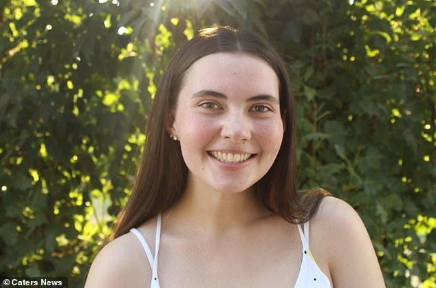 Se baña dos veces al mes porque es alérgica al agua: el drama de tomar, llorar y salir cuando llueve | Internacionales