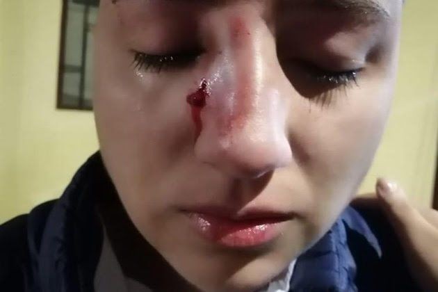 Brutal paliza de un taxista a una mujer por ser lesbiana: "El machito no va a pagar" | Internacionales