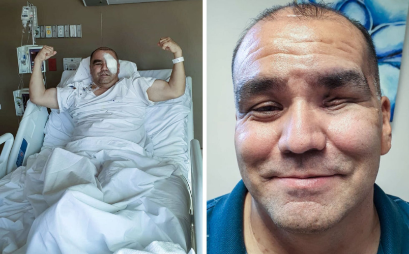 Sobreviviente del terrorífico hongo negro: “Me despertaba en la madrugada llorando del dolor” | Internacionales