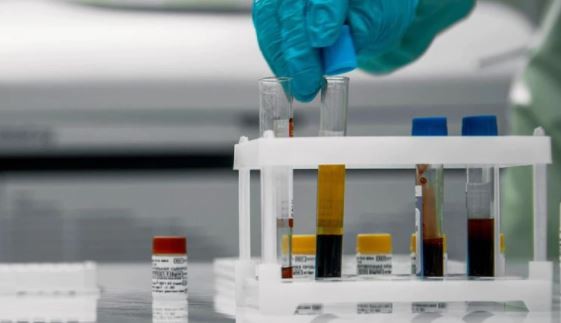 Una mujer de 90 años murió de Covid infectada por dos variantes diferentes en Bélgica | Internacionales