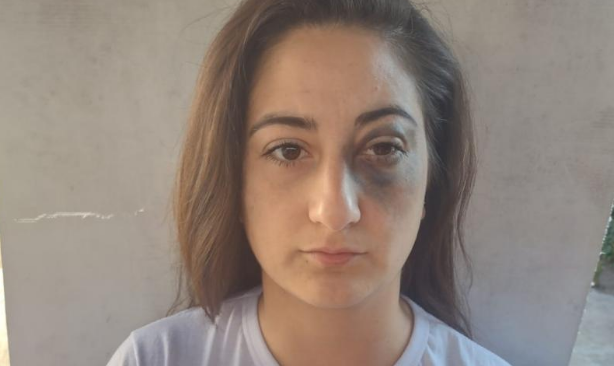 Un policía golpeó a una mujer tras un control policial | Córdoba