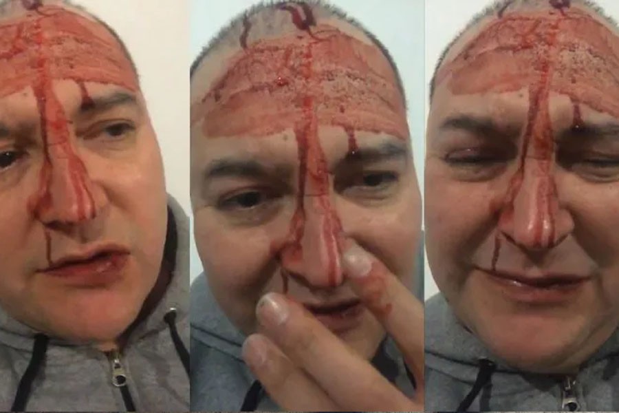 El video del brutal ataque a Leo García | Actualidad