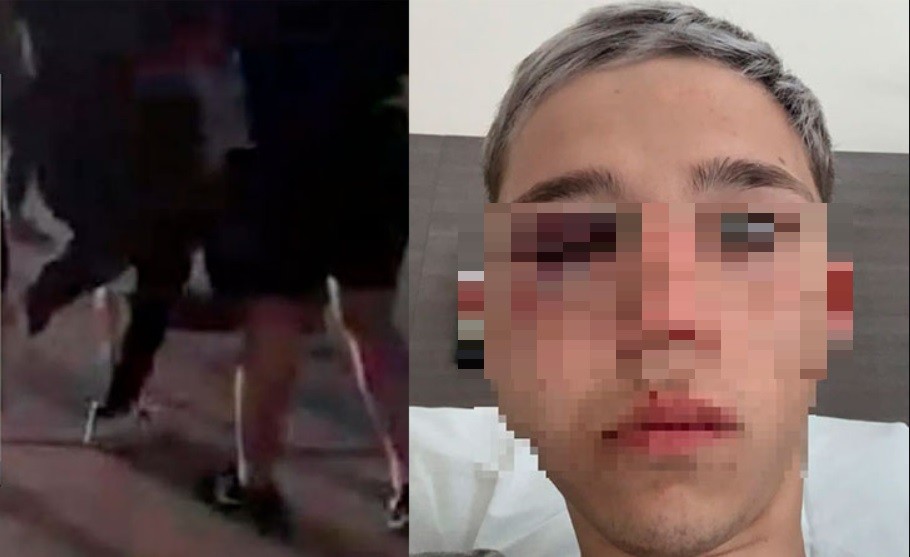 Identificaron a dos rugbiers acusados de golpear a un adolescente en una fiesta de 15 | Actualidad