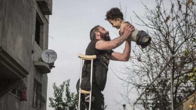 Italia, movilizada para ayudar a Mustafa: el nene sirio que no tiene ni brazos, ni piernas | Internacionales