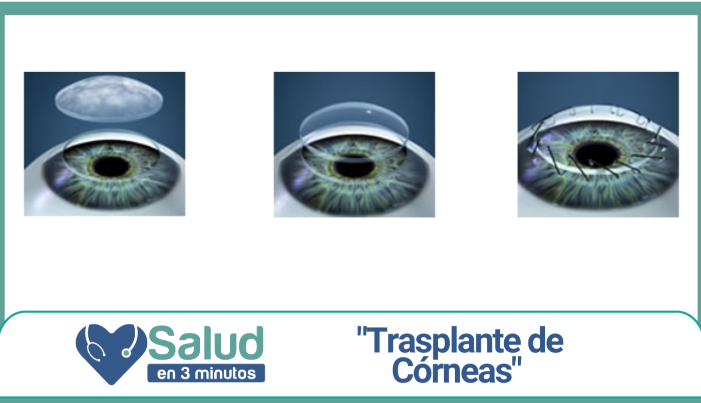 TRASPLANTE DE CÓRNEA: Solidaridad, altruismo, inclusión social y calidad de vida | Salud
