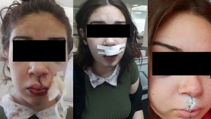 Denuncia de grave golpiza a manos de policías fue desestimada por la justicia | Córdoba