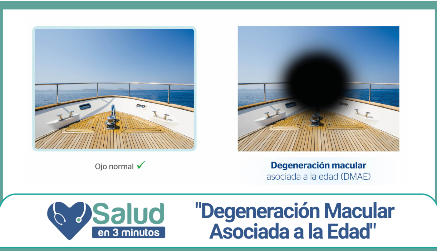Degeneración macular asociada a la edad: ¿De qué se trata? | Salud
