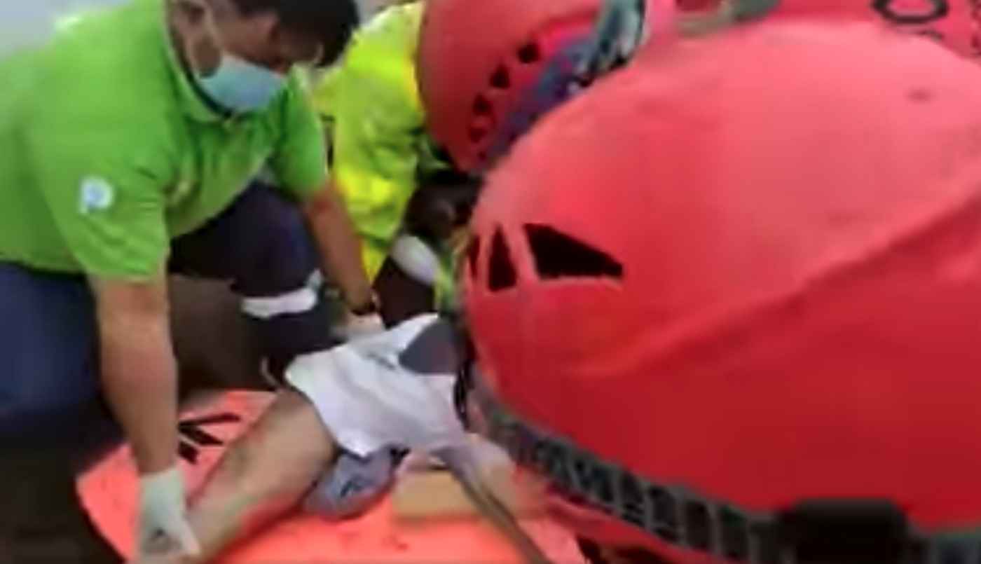 Video | Una sombrilla voló por la playa, se clavó en la pierna de un joven y se la sacaron con una motosierra | Actualidad