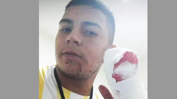 Detienen al “Negro Juan” el presunto atacante del cadete que perdió cuatro dedos | Actualidad