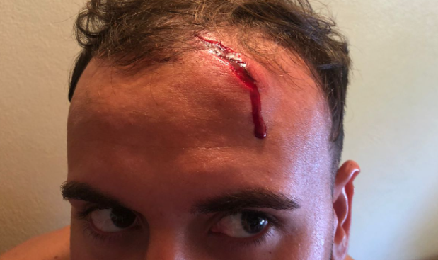 Mapuches atacaron con boleadoras y piedras a turistas que intentaron esquivar un corte en la ruta | Actualidad