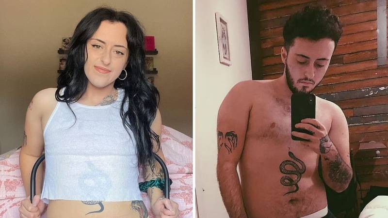 Joven que se operó para ser hombre trans se arrepintió y volvió a ser mujer | Curiosidades
