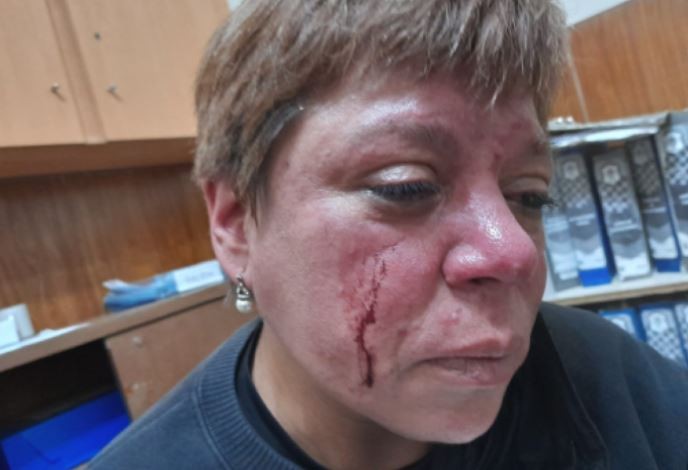 Una inspectora municipal fue agredida en La Plata por los dueños de una hamburguesería | Actualidad