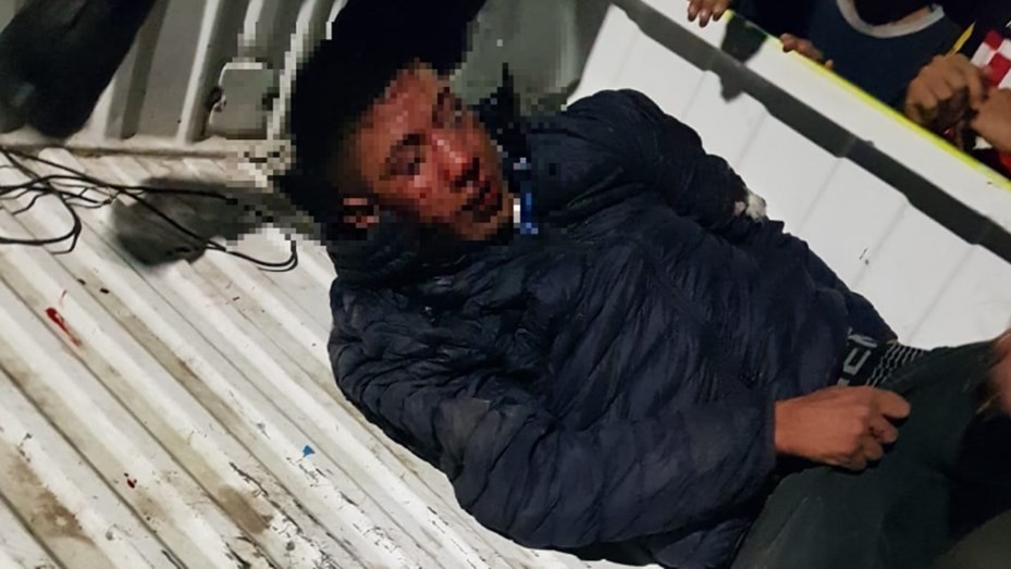 Hartos de la inseguridad, vecinos lincharon y le amputaron dos dedos a un ladrón | Actualidad