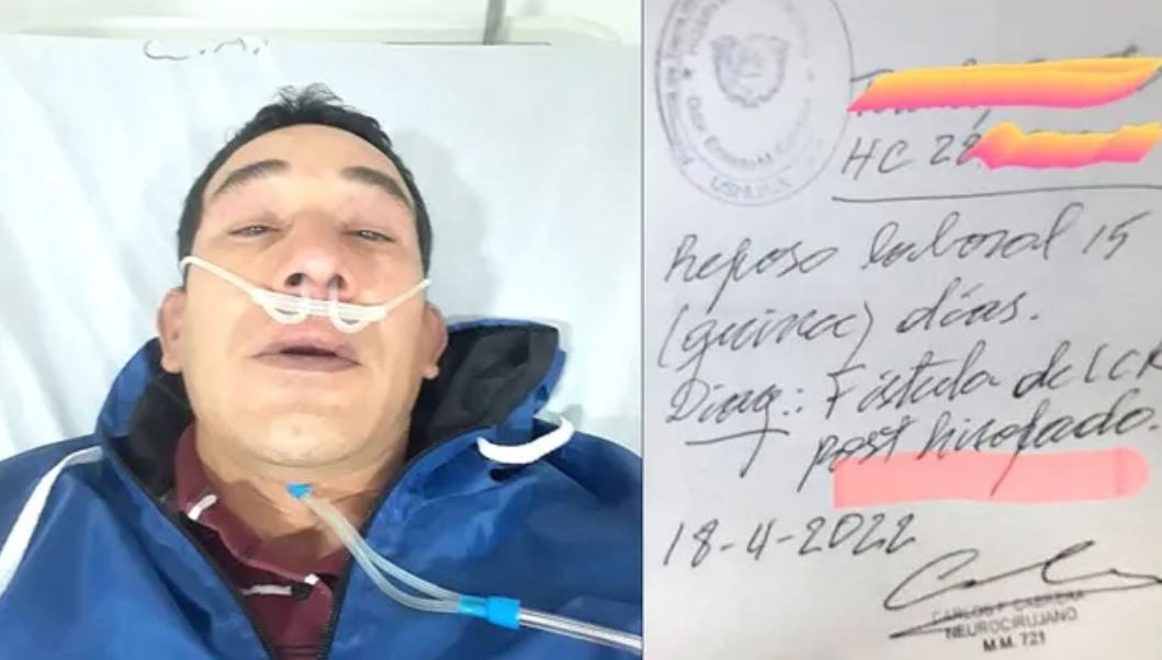 Perdió líquido cefalorraquídeo por un hisopado: "La médica que me atendió estaba enojada" | Actualidad