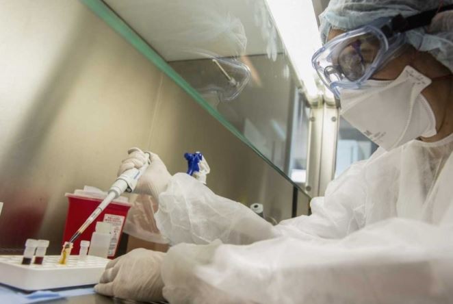 Viruela del mono: afirman que hay "altas probabilidades" de que el caso sospechoso en la Argentina sea positivo | Actualidad