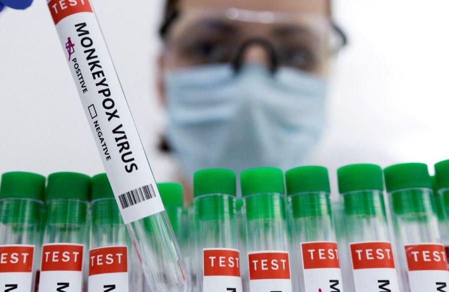 Viruela del mono: la OPS aseguró que América registra casi un tercio del total mundial de los casos | Internacionales